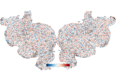 Plot dropout regions on the flatmap