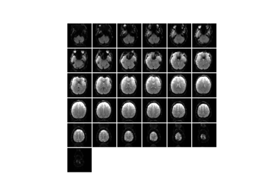 Mosaic plot