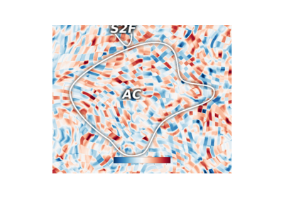 Plotting a zoomed view of one ROI